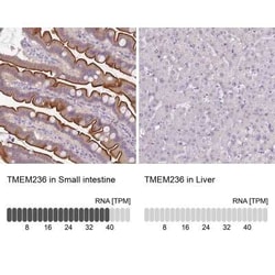TMEM236 Antibody, Novus Biologicals:Antibodies:Primary Antibodies