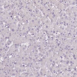 TMEM236 Antibody, Novus Biologicals:Antibodies:Primary Antibodies