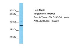 TMEM26 Rabbit anti-Human, Polyclonal, Novus Biologicals 0.1 mL | Buy Online | Novus Biologicals | Fisher Scientific