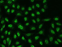 TMEM38A Antibody, Novus Biologicals 50 &mu;g, Unconjugated:Antibodies,