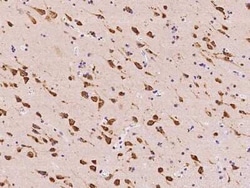 TMEM38A Antibody, Novus Biologicals 50 &mu;g, Unconjugated:Antibodies,