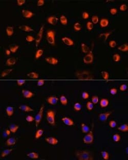 TMEM44 Antibody - Azide and BSA Free, Novus Biologicals 0.02 mL; Unconjugated:Antibodies,