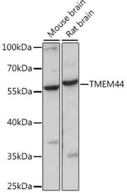 TMEM44 Antibody - Azide and BSA Free, Novus Biologicals 0.02 mL; Unconjugated:Antibodies,