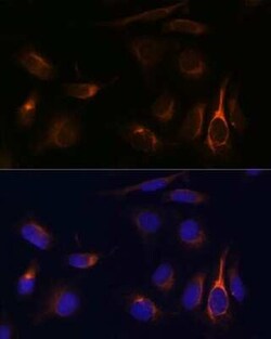 TMEM49 Antibody - Azide and BSA Free, Novus Biologicals 0.02 mL, Unconjugated:Antibodies,