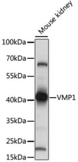 TMEM49 Antibody - Azide and BSA Free, Novus Biologicals 0.02 mL, Unconjugated:Antibodies,
