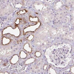 TMEM52B Antibody, Novus Biologicals:Antibodies:Primary Antibodies