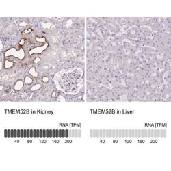 TMEM52B Antibody, Novus Biologicals:Antibodies:Primary Antibodies