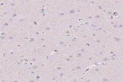 TMEM52B Antibody, Novus Biologicals:Antibodies:Primary Antibodies