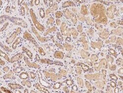 TMEM52B Antibody, Novus Biologicals:Antibodies:Primary Antibodies