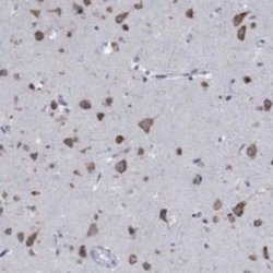 TMEM59 Rabbit anti-Human, Polyclonal, Novus Biologicals 25 &mu;g; Unconjugated:Antibodies,