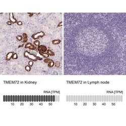 TMEM72 Antibody, Novus Biologicals 25 &mu;L, Unconjugated:Antibodies, Polyclonal