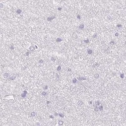 TMEM72 Antibody, Novus Biologicals 25 &mu;L, Unconjugated:Antibodies, Polyclonal