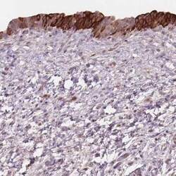 TMEM80 Antibody, Novus Biologicals 25 &mu;L, Unconjugated:Antibodies, Polyclonal