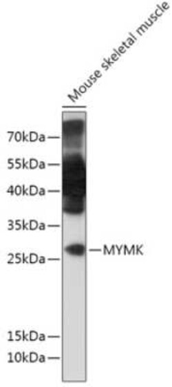 TMEM8C Antibody - Azide and BSA Free, Novus Biologicals 0.1 mL; Unconjugated:Antibodies,