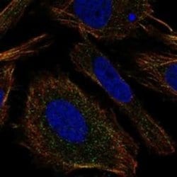 TMEM9 Rabbit anti-Human, Polyclonal, Novus Biologicals 100 &mu;g; Unconjugated:Antibodies,