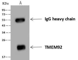 TMEM92 Antibody, Novus Biologicals 50 &mu;g; Unconjugated:Antibodies, Polyclonal