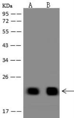 TMEM92 Antibody, Novus Biologicals 50 &mu;g; Unconjugated:Antibodies, Polyclonal