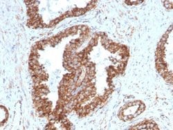 TMEPAI, Mouse anti-Human, Clone: PMEPA1/2698, Novus Biologicals:Antibodies:Primary