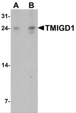 TMIGD1 Antibody - BSA Free, Novus Biologicals 0.1 mg; Unconjugated:Antibodies,