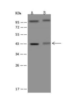 TMLHE Antibody, Novus Biologicals:Antibodies:Primary Antibodies
