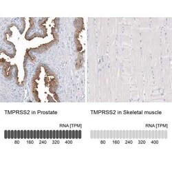 TMPRSS2 Antibody (CL12512), Novus Biologicals 100 &mu;g; Unconjugated:Antibodies,
