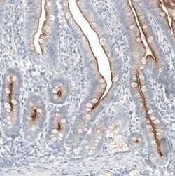 TMPRSS2 Antibody (CL12512), Novus Biologicals 100 &mu;g; Unconjugated:Antibodies,