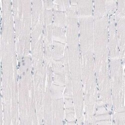 TMPRSS2 Antibody (CL12512), Novus Biologicals 100 &mu;g; Unconjugated:Antibodies,