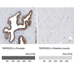TMPRSS2 Antibody (CL12511), Novus Biologicals 100 &mu;g; Unconjugated:Antibodies,