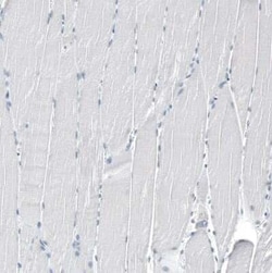 TMPRSS2 Antibody (CL12511), Novus Biologicals 100 &mu;g; Unconjugated:Antibodies,