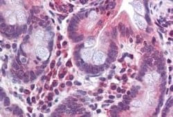 TMPRSS4 Antibody, Novus Biologicals 50 &mu;g | Buy Online | Novus Biologicals | Fisher Scientific