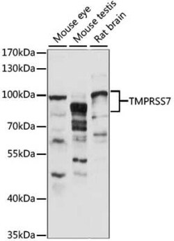 TMPRSS7 Antibody - Azide and BSA Free, Novus Biologicals:Antibodies:Primary