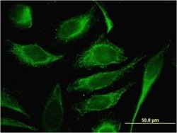 TMSB4Y Antibody (6G4), Novus Biologicals 0.1 mg | Buy Online | Novus Biologicals | Fisher Scientific