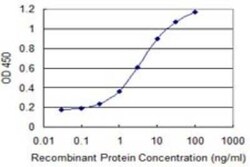 TMSB4Y Antibody (6G4), Novus Biologicals 0.1 mg | Buy Online | Novus Biologicals | Fisher Scientific