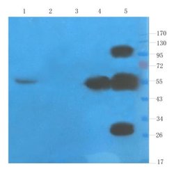 TNF-alpha Antibody (CDP 571 (Humicade)) - Azide and BSA Free, Novus Biologicals