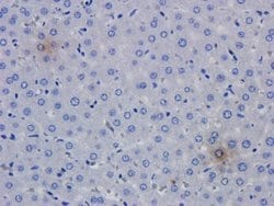 TNF-alpha Antibody (CDP 571 (Humicade)) - Azide and BSA Free, Novus Biologicals