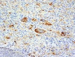 TNF-alpha Antibody (TNFA/1172), Novus Biologicals:Antibodies:Primary Antibodies