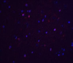 TNFAIP1 Antibody - BSA Free, Novus Biologicals 0.1 mg; Unconjugated:Antibodies,