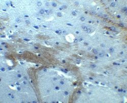 TNFAIP1 Antibody - BSA Free, Novus Biologicals 0.1 mg; Unconjugated:Antibodies,