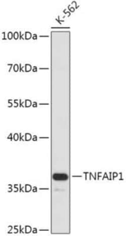TNFAIP1 Antibody - Azide and BSA Free, Novus Biologicals:Antibodies:Primary