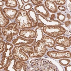 TNIP2 Antibody, Novus Biologicals 25 &mu;L, Unconjugated:Antibodies, Polyclonal