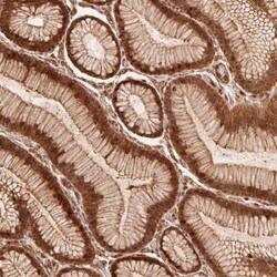 TNIP2 Antibody, Novus Biologicals:Antibodies:Primary Antibodies