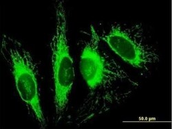 TOM70 Antibody, Novus Biologicals 0.05 mg | Buy Online | Novus Biologicals | Fisher Scientific