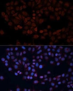 TOM70 Antibody - Azide and BSA Free, Novus Biologicals 0.02 mL; Unconjugated:Antibodies,
