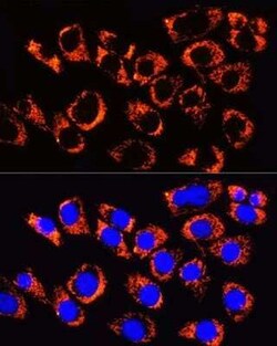 TOMM20 Rabbit anti-Human, Mouse, Rat, Clone: 6E0N2, Novus Biologicals 100