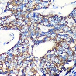 TOMM20 Rabbit anti-Human, Mouse, Rat, Clone: 6E0N2, Novus Biologicals 100