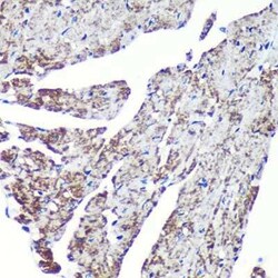 TOMM20 Rabbit anti-Human, Mouse, Rat, Clone: 6E0N2, Novus Biologicals 100