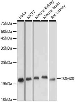 TOMM20 Rabbit anti-Human, Mouse, Rat, Clone: 6E0N2, Novus Biologicals 100