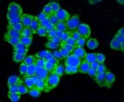TOMM20 Antibody (ST04-72), Novus Biologicals 100&mu;L:Antibodies, Monoclonal