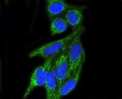 TOMM20 Antibody (ST04-72), Novus Biologicals 100&mu;L:Antibodies, Monoclonal