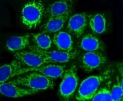 TOMM20 Antibody (ST04-72), Novus Biologicals 100&mu;L:Antibodies, Monoclonal